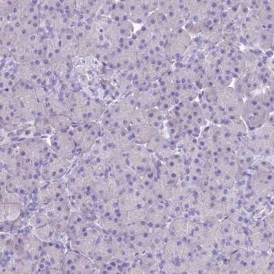 Immunohistochemistry-Paraffin: KIAA0408 Antibody [NBP1-94158]