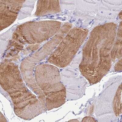 Immunohistochemistry-Paraffin: KIAA0408 Antibody [NBP1-94158]