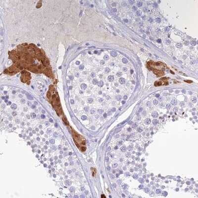 Immunohistochemistry-Paraffin: KIAA0408 Antibody [NBP1-94158]