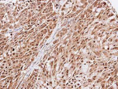 Immunohistochemistry-Paraffin: EFCAB14 Antibody [NBP1-33182]
