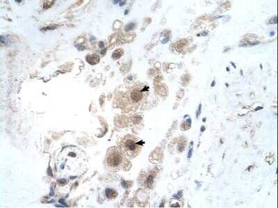 Immunohistochemistry-Paraffin: EFCAB14 Antibody [NBP1-59967]