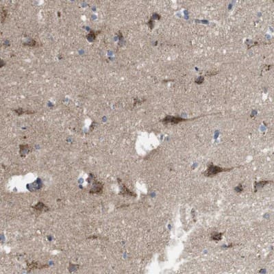 Immunohistochemistry-Paraffin: EFCAB14 Antibody [NBP1-86098]