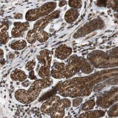 Immunohistochemistry-Paraffin: EFCAB14 Antibody [NBP1-86104]