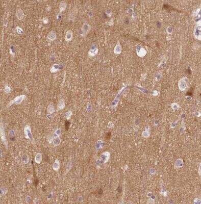 Immunohistochemistry-Paraffin: KIAA0513 Antibody [NBP1-86075]