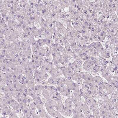 Immunohistochemistry-Paraffin: KIAA0513 Antibody [NBP1-86075]