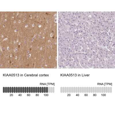 Immunohistochemistry-Paraffin: KIAA0513 Antibody [NBP1-86075]