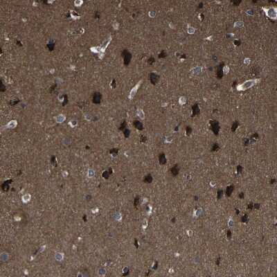 Immunohistochemistry-Paraffin: KIAA0513 Antibody [NBP1-86470]