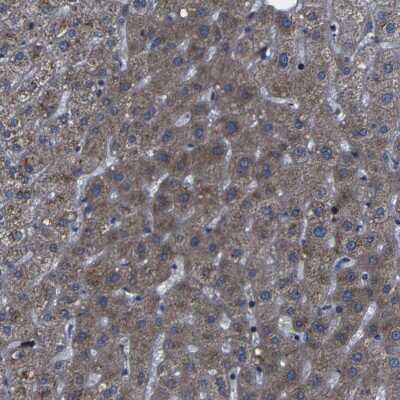 Immunohistochemistry-Paraffin: KIAA0513 Antibody [NBP1-86470]