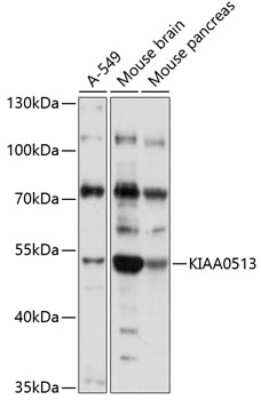 Western Blot: KIAA0513 AntibodyAzide and BSA Free [NBP3-04654]