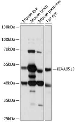 Western Blot: KIAA0513 AntibodyAzide and BSA Free [NBP3-04655]