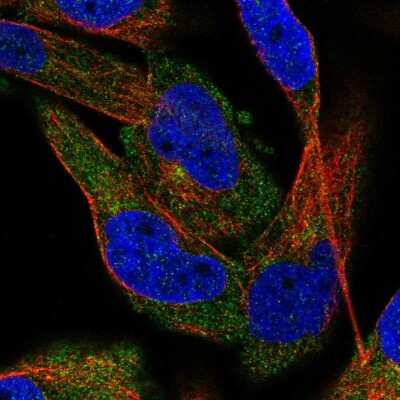 Immunocytochemistry/ Immunofluorescence: C2CD5 Antibody [NBP1-92050]