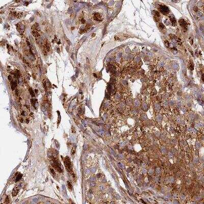 Immunohistochemistry-Paraffin: C2CD5 Antibody [NBP1-92050]