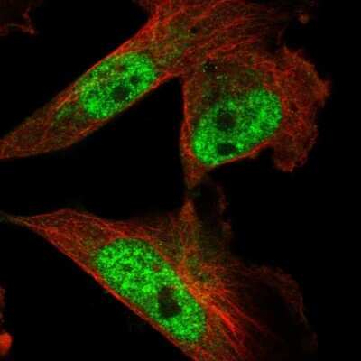 Immunocytochemistry/ Immunofluorescence: KIAA0556 Antibody [NBP1-91006]