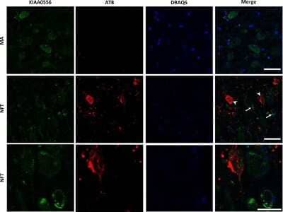 Immunocytochemistry/ Immunofluorescence: KIAA0556 Antibody [NBP1-91006]