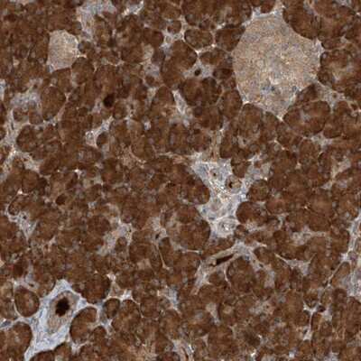 Immunohistochemistry-Paraffin: KIAA0556 Antibody [NBP1-90912]