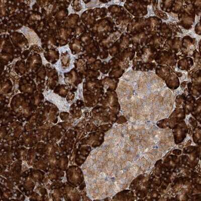 Immunohistochemistry-Paraffin: KIAA0556 Antibody [NBP1-91006]