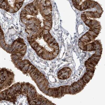 Immunohistochemistry-Paraffin: KIAA0556 Antibody [NBP1-91006]