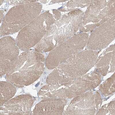 Immunohistochemistry-Paraffin: KIAA0556 Antibody [NBP1-91006]