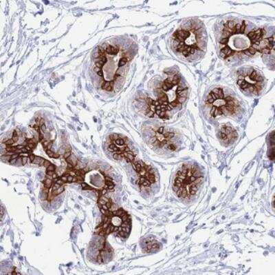 Immunohistochemistry: VWA8 Antibody [NBP2-30888]