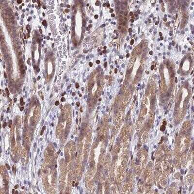 Immunohistochemistry-Paraffin: PPP1R26 Antibody [NBP1-86539]