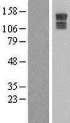 Western Blot: PPP1R26 Overexpression Lysate [NBL1-12252]