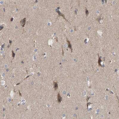 Immunohistochemistry-Paraffin: KIAA0753/MNR Antibody [NBP1-90929]