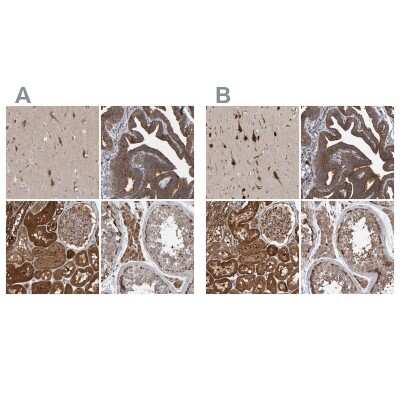 Immunohistochemistry-Paraffin: KIAA0753/MNR Antibody [NBP1-90929]