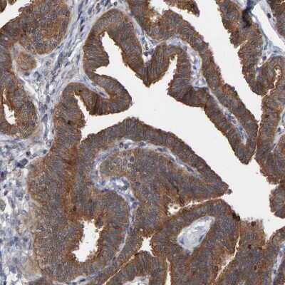 Immunohistochemistry-Paraffin: KIAA0753/MNR Antibody [NBP1-90929]