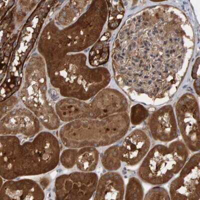 Immunohistochemistry-Paraffin: KIAA0753/MNR Antibody [NBP1-90929]