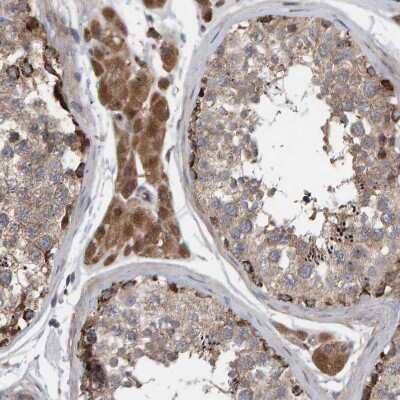 Immunohistochemistry-Paraffin: KIAA0753/MNR Antibody [NBP1-90929]