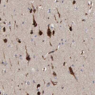 Immunohistochemistry-Paraffin: KIAA0753/MNR Antibody [NBP1-90931]