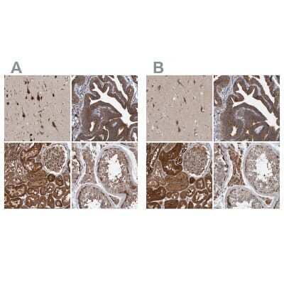 Immunohistochemistry-Paraffin: KIAA0753/MNR Antibody [NBP1-90931]