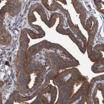 Immunohistochemistry-Paraffin: KIAA0753/MNR Antibody [NBP1-90931]