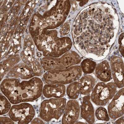 Immunohistochemistry-Paraffin: KIAA0753/MNR Antibody [NBP1-90931]