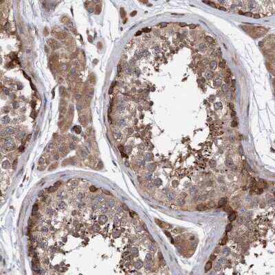 Immunohistochemistry-Paraffin: KIAA0753/MNR Antibody [NBP1-90931]