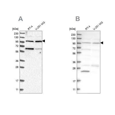 Western Blot: KIAA0753/MNR Antibody [NBP1-90931]