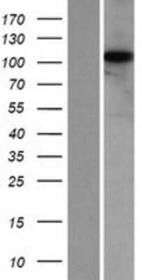 Western Blot: KIAA0753/MNR Overexpression Lysate [NBP2-07273]