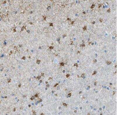 Immunohistochemistry: KIAA0895 Antibody [NBP2-30822]