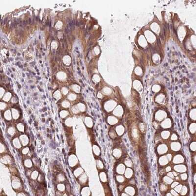 Immunohistochemistry-Paraffin: KIAA0895L Antibody [NBP2-38082]