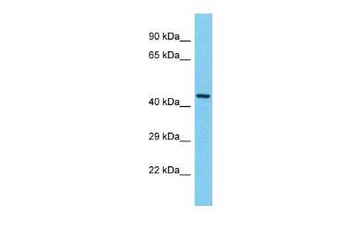 Western Blot: KIAA0895L Antibody [NBP2-83108]