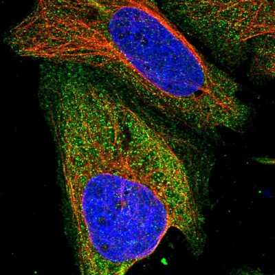 Immunocytochemistry/ Immunofluorescence: ZSWIM8 Antibody [NBP1-90878]