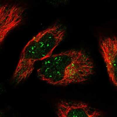 Immunocytochemistry/ Immunofluorescence: TMEM131L Antibody [NBP2-30898]