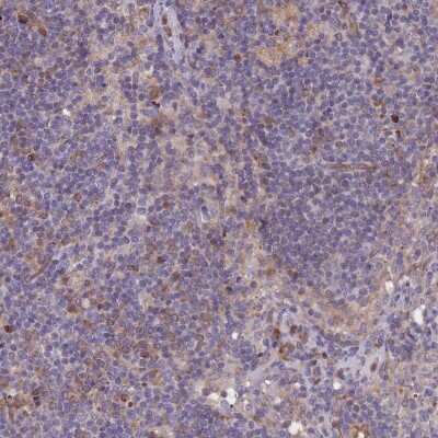 Immunohistochemistry-Paraffin: TMEM131L Antibody [NBP2-30789]