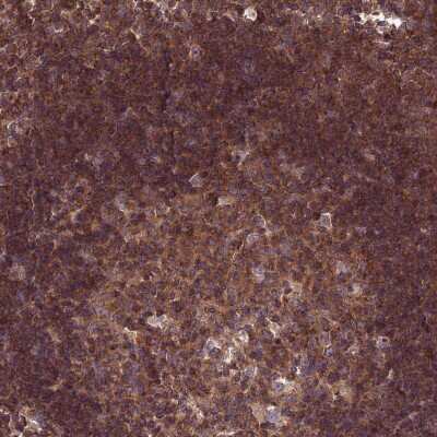 Immunohistochemistry-Paraffin: TMEM131L Antibody [NBP2-30898]