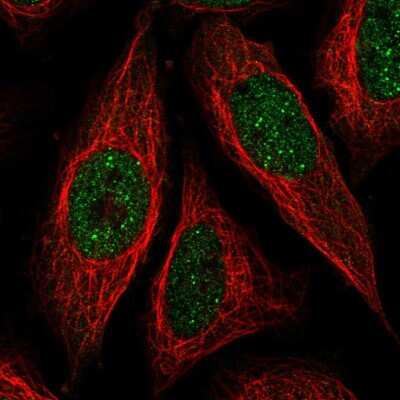 Immunocytochemistry/ Immunofluorescence: ICE1 Antibody [NBP2-56760]