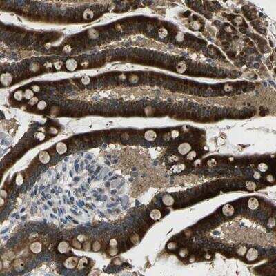 Immunohistochemistry-Paraffin: MIR1-1 Host Gen Antibody [NBP2-14486]