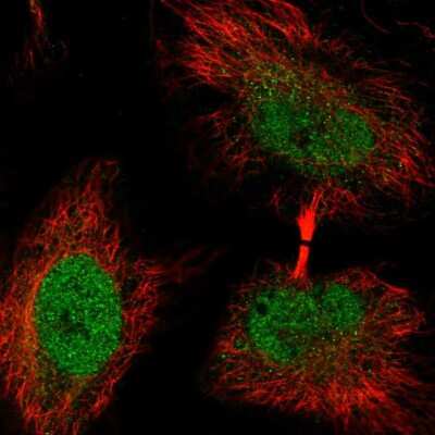 Immunocytochemistry/ Immunofluorescence: WASHC4 Antibody [NBP2-47410]