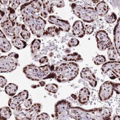 Immunohistochemistry-Paraffin: WASHC4 Antibody [NBP2-47409]