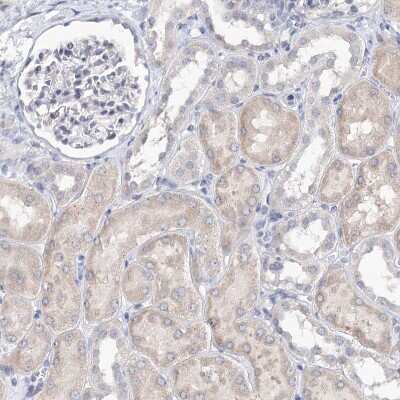 Immunohistochemistry-Paraffin: KIAA1109/FSA Antibody [NBP1-82145]