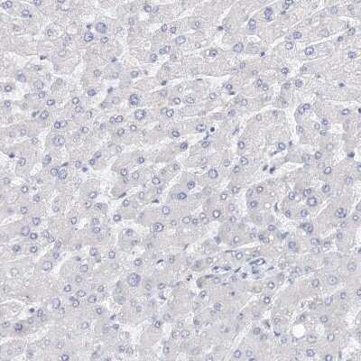 Immunohistochemistry-Paraffin: KIAA1109/FSA Antibody [NBP1-82145]